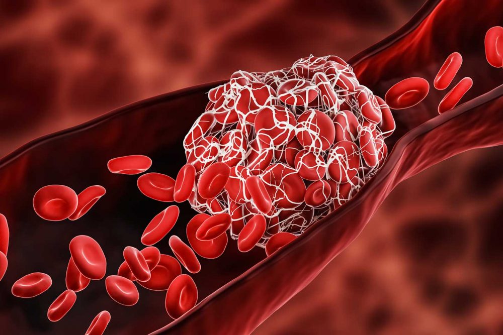 Giảm mức cholesterol